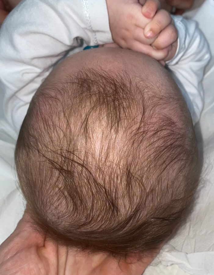 Crâne du bébé vu de dessus, après l'accompagnement