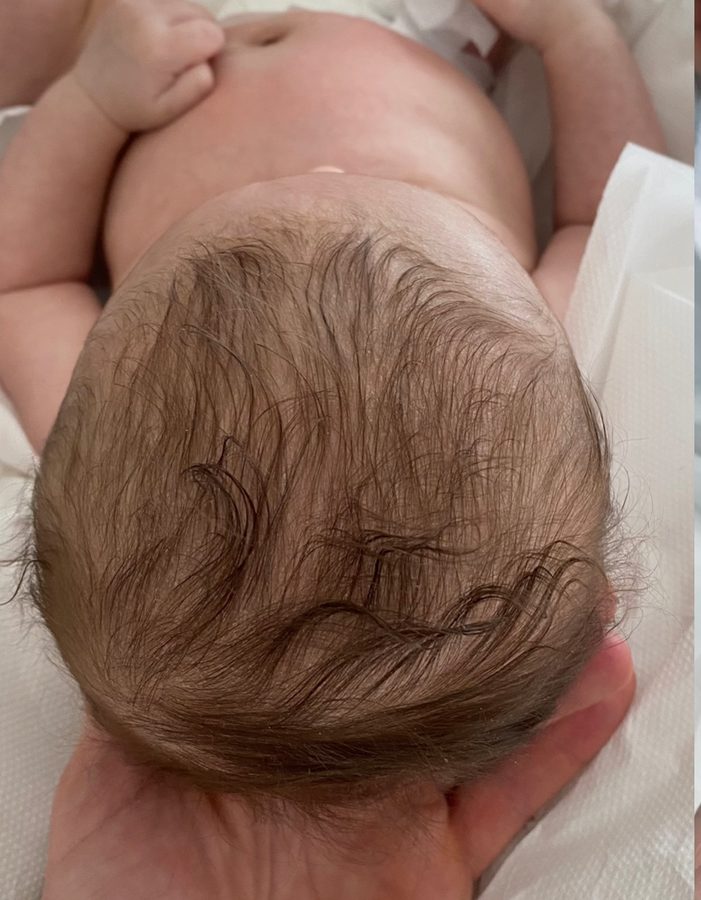 Crâne du bébé vu de dessus, avant l'accompagnement